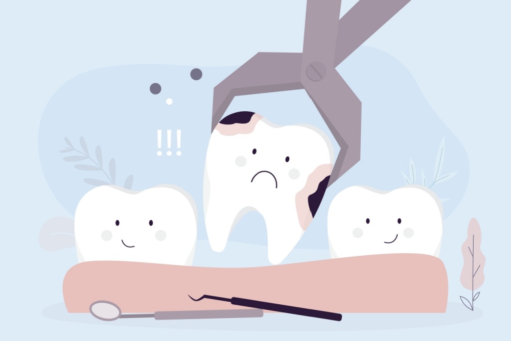 tooth extraction burlington ct