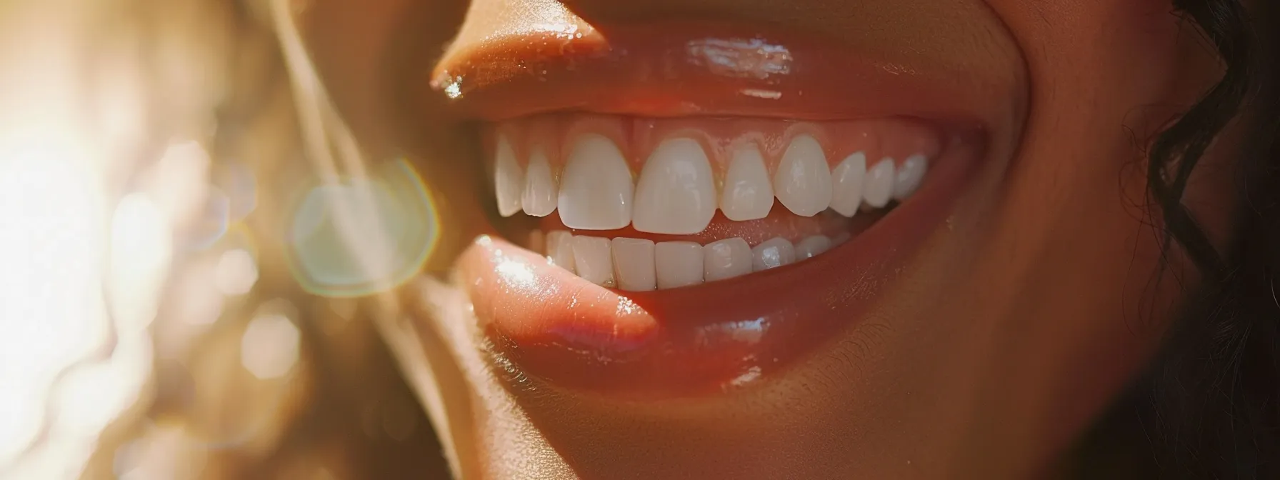 How At-Home Whitening Kits Work