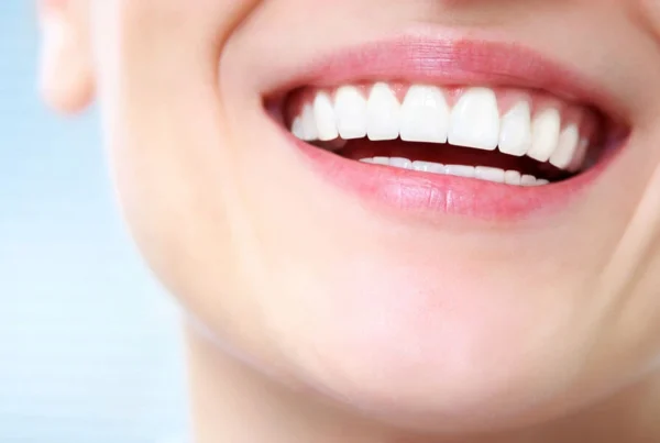 Tips for Maintaining Whitened Teeth