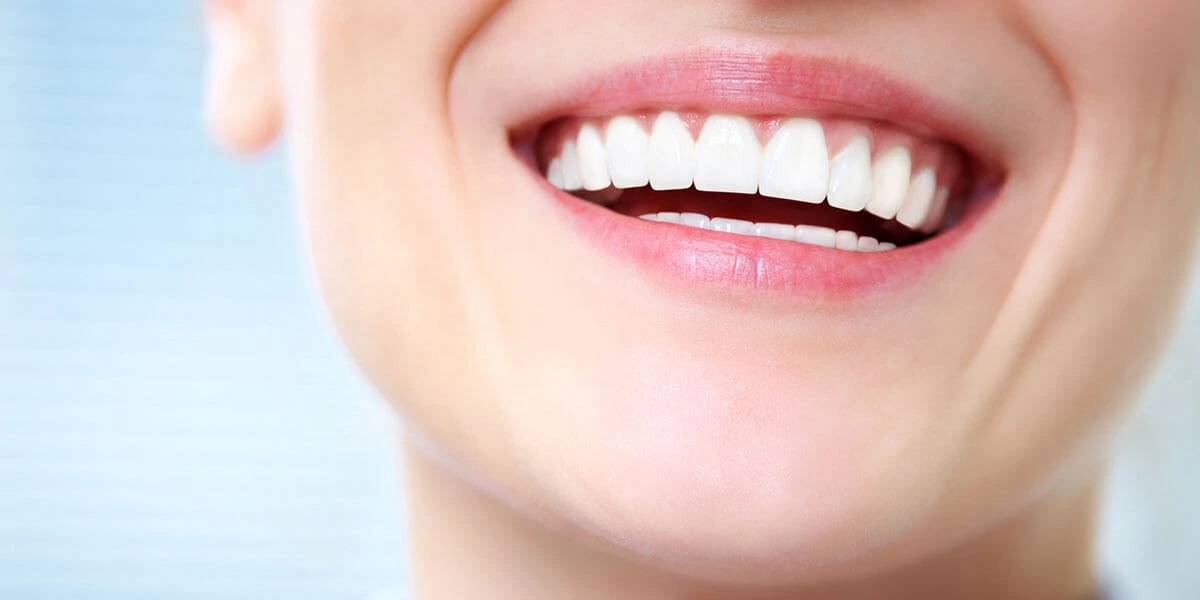 Tips for Maintaining Whitened Teeth