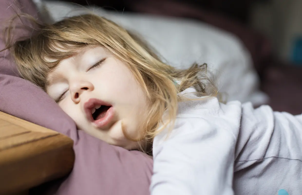 Myofunctional Therapy: Improve Pediatric Sleep Apnea?